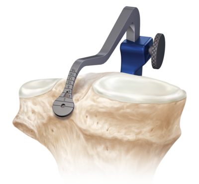 /uploads/assets-v1/578d2486-ba85-4707-9525-97888497f798/pcl_reconstruction_0-large.png