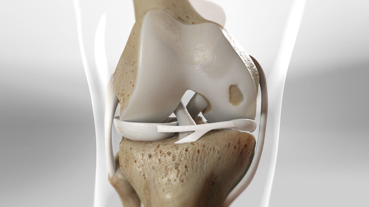 artroscopie regenerare cartilaj genunchi